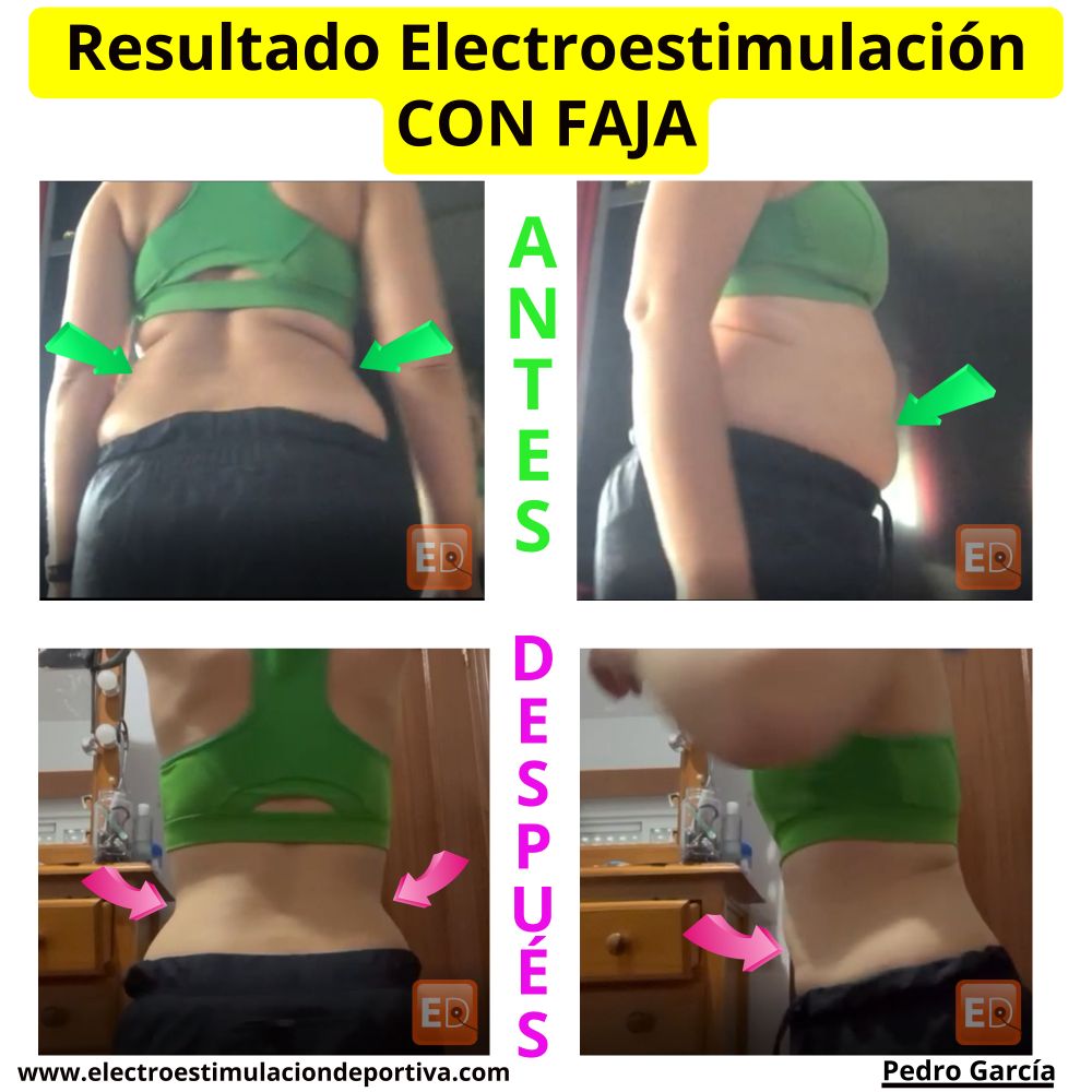 Estimulador Muscular Abdomen Eléctrico Brazos Grasa