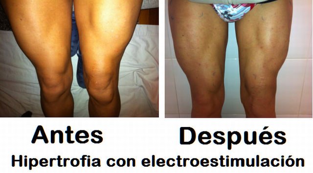 Maximice sus ganancias musculares con el electroestimulador