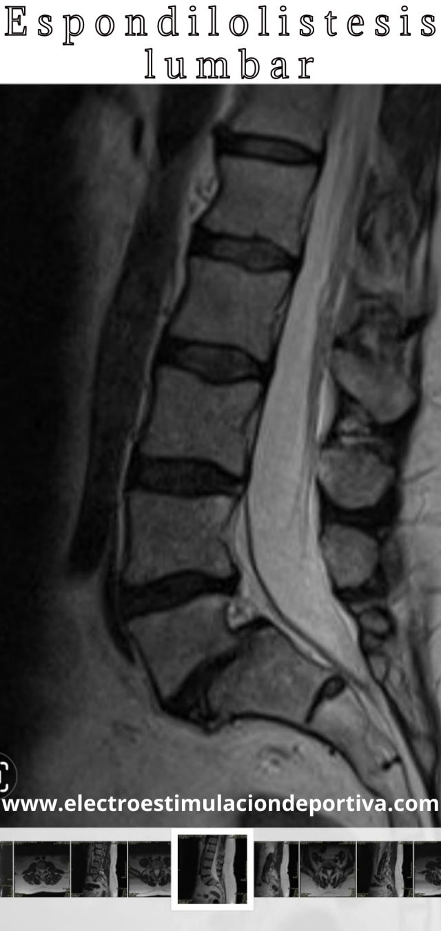 Apoya Espalda Lumbar – Asistronic