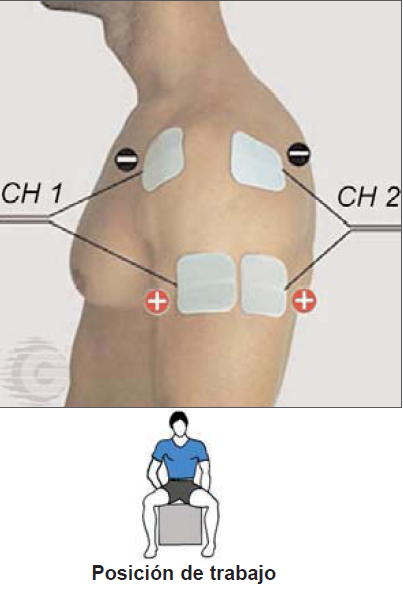 TENS Electrodos En Terapia Física, Colocando Sobre Los Hombros